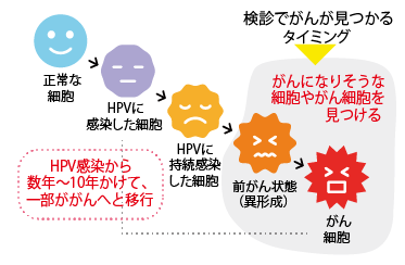 HPV感染細胞からがん細胞へ